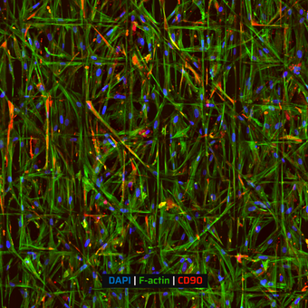 Aligned Pattern with Catching Fibers
