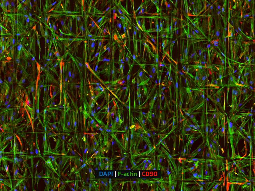 Aligned Pattern with Catching Fibers