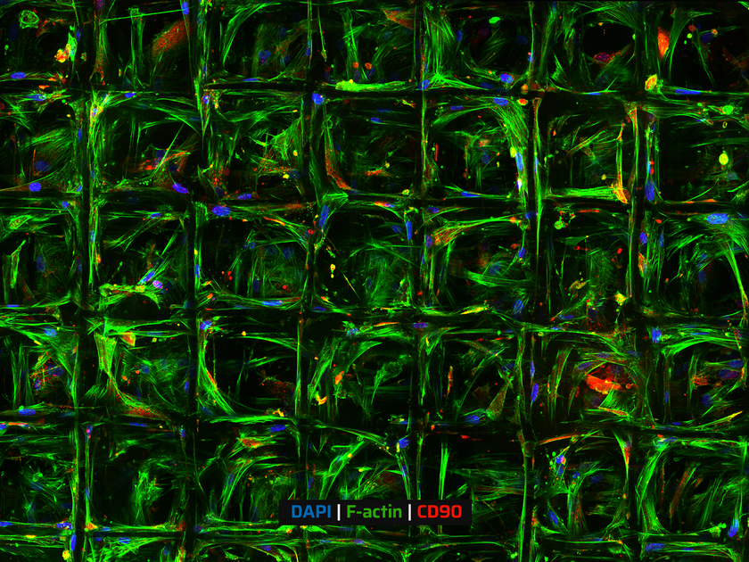 Box Pattern